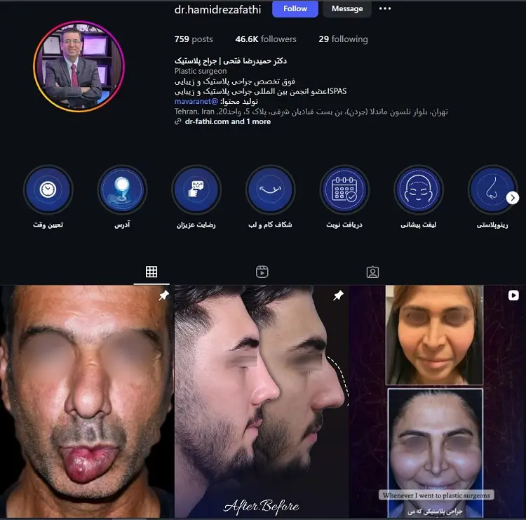 دکتر حمیدرضا فتحی جراح زیبایی بینی در تهران
