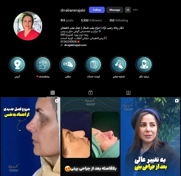 دکتر ربانه رجبی نژاد؛ جراح خانم عمل بینی در رشت