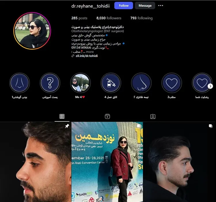 دکتر ریحانه توحیدی، جراح عمل بینی در کرمان