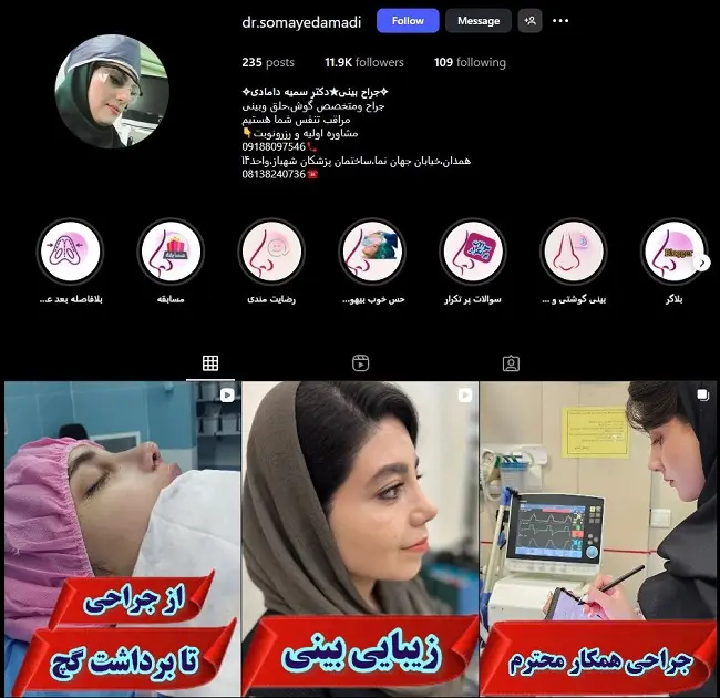 دکتر سمیه دامادی، جراح خانم عمل بینی در بندرعباس