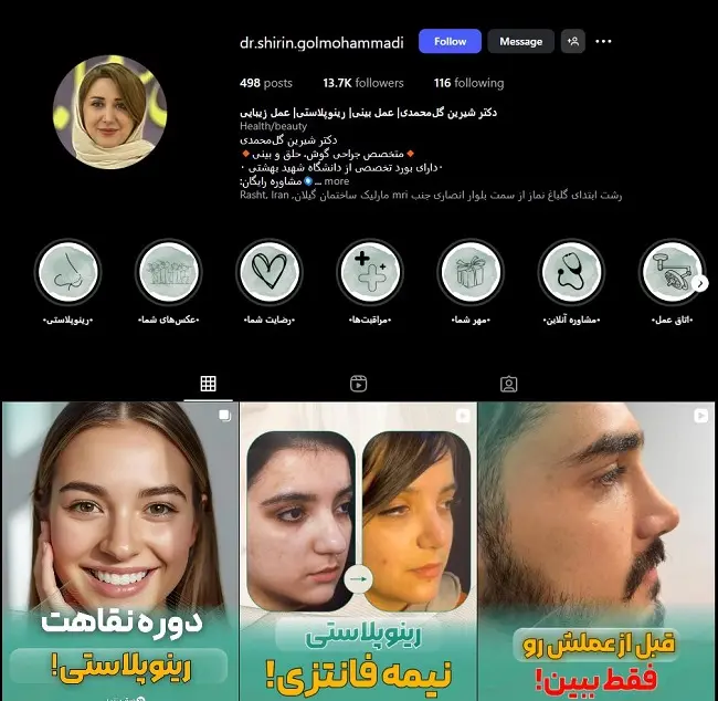 دکتر شیرین گل محمدی، بهترین جراح خانم عمل بینی در رشت