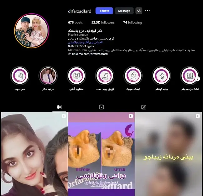 جراح بینی در مشهد، اسماعیل فرزاد فرد