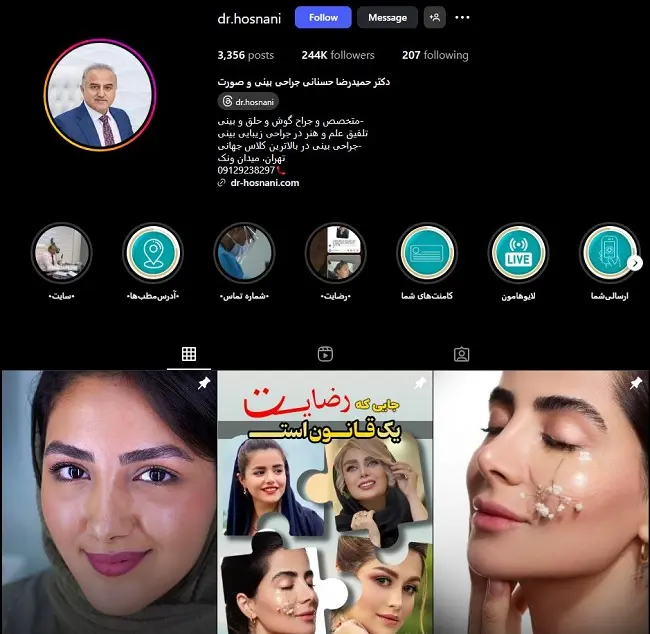 بهترین دکتر جراح بینی طبیعی در تهران، حمید رضا حسنانی
