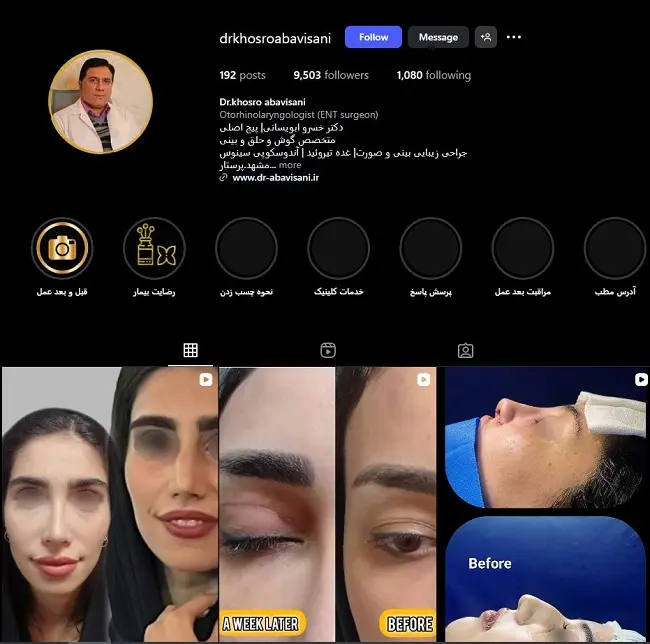 پزشک عمل بینی در مشهد، خسرو ابویسانی