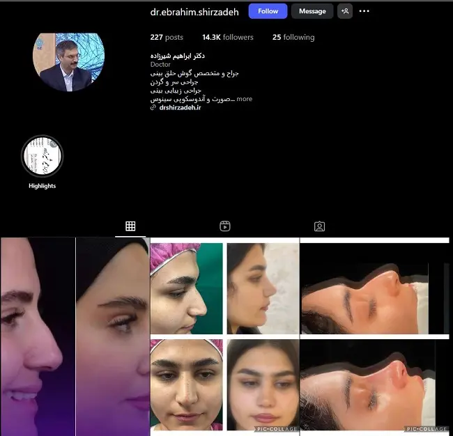 دکتر عمل بینی در ارومیه، ابراهیم شیرزاد