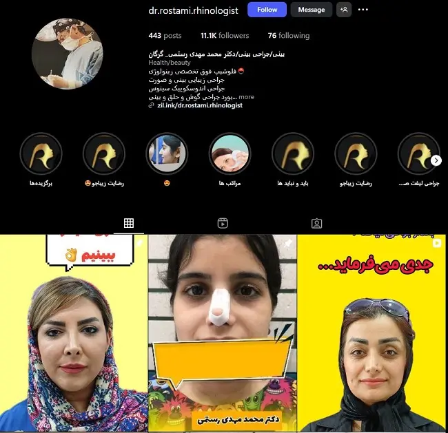 دکتر عمل بینی درد گرگان، محمدمهدی رستمی