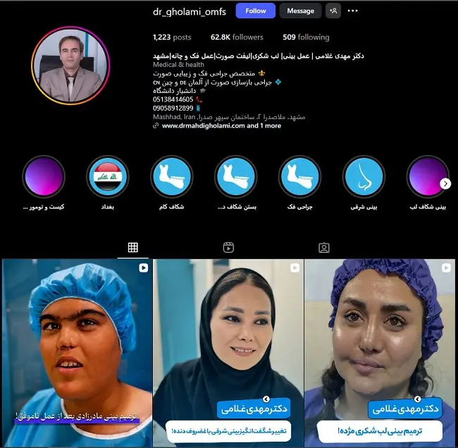 دکتر جراح بینی مهدی غلامی