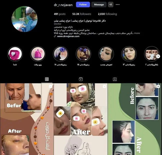 پزشک عمل بینی در تبریز، غلامرضا نوجوان تبریز