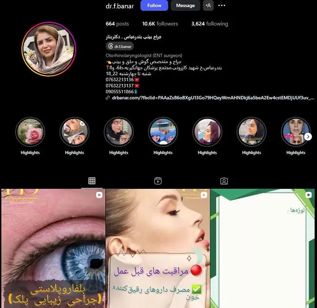 دکتر فائقه بنار،جراح خانم عمل بینی در بندرعباس