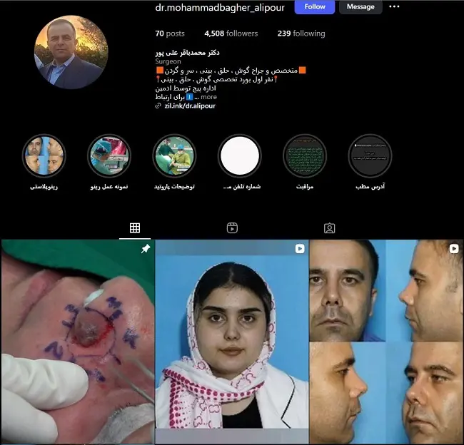 دکتر عمل بینی در ارومیه، محمد باقر علیپور