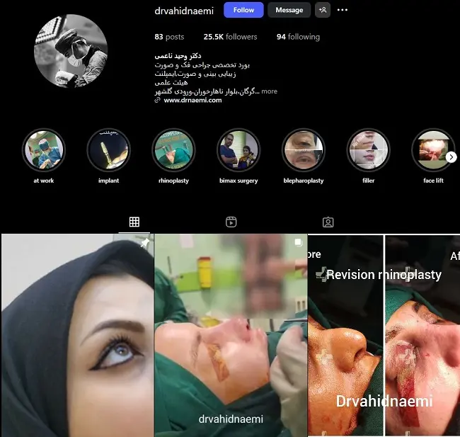 دکتر وحید ناعمی جراح عمل بینی در گرگان