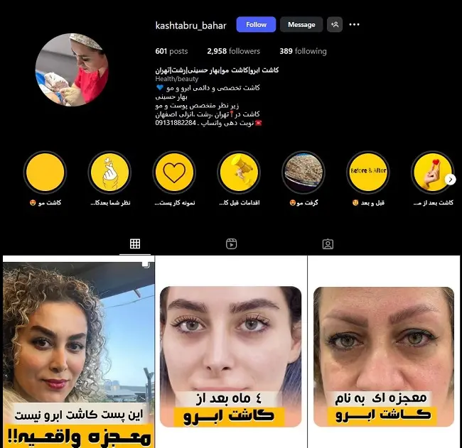 کلینیک کاشت مو بهار حسینی