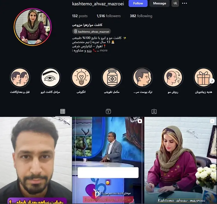 دکتر کاشت مو زهرا مزروعی اهواز