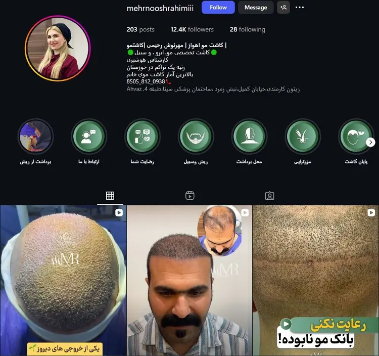 مهرنوش رحیمی، دکتر کاشت مو در اهواز