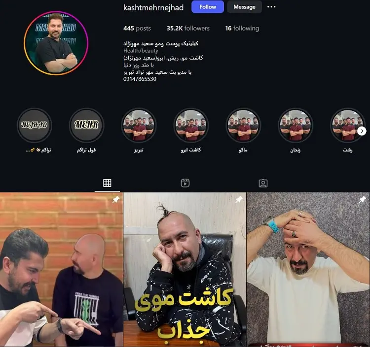 دکتر کاشت مو مهرنژاد تبریز