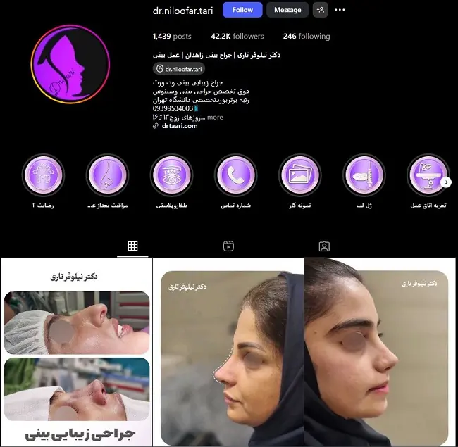 دکتر نیلوفر تاری، جراح خانم عمل بینی در زاهدان