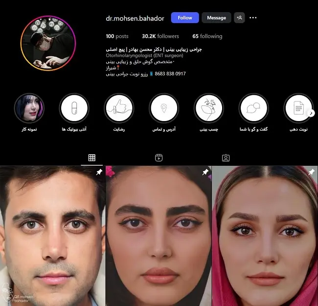 پزشک جراحی بینی در شیراز، محسن بهادر
