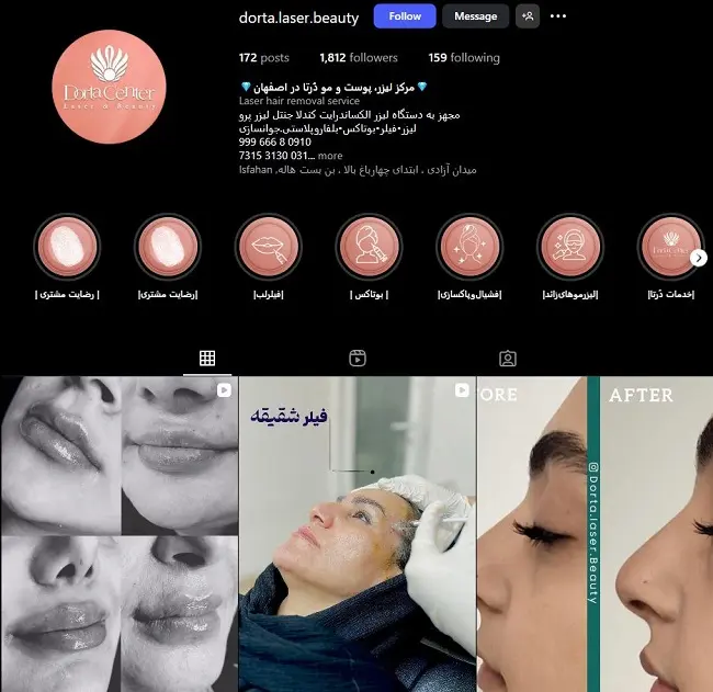 مرکز لیزر درتا اصفهان