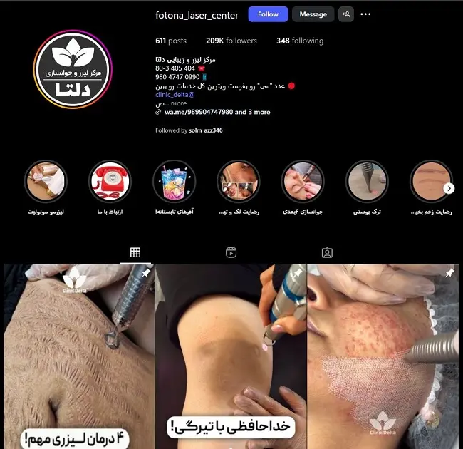 مرکز لیزر دلتا