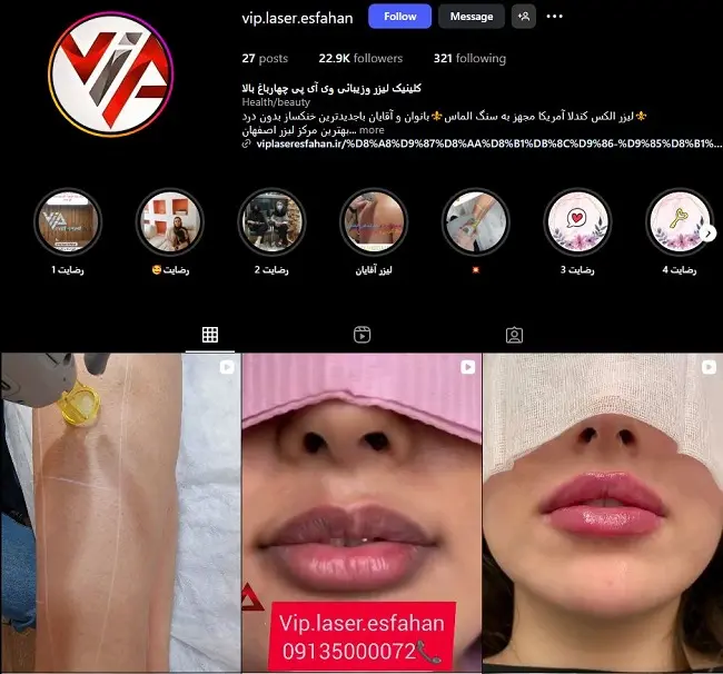 مرکز لیزر اصفهان چهارباغ