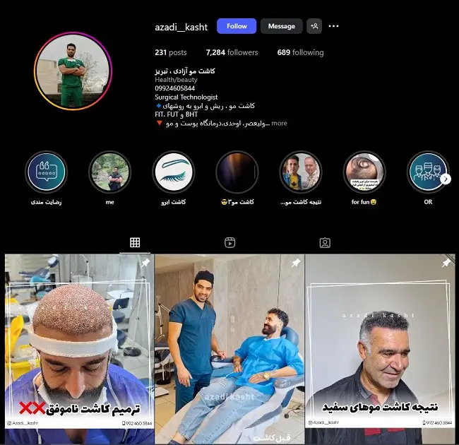 مرکز کاشت مو آزادی تبریز
