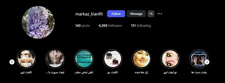 مرکز کاشت مو کیان فیت