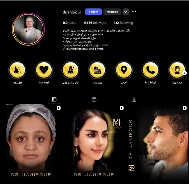 پزشک عمل بینی مسعود جانی پور شیراز