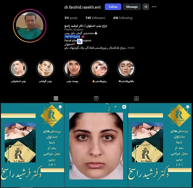 دکتر عمل بینی در اضفهان، فرشید راسخ
