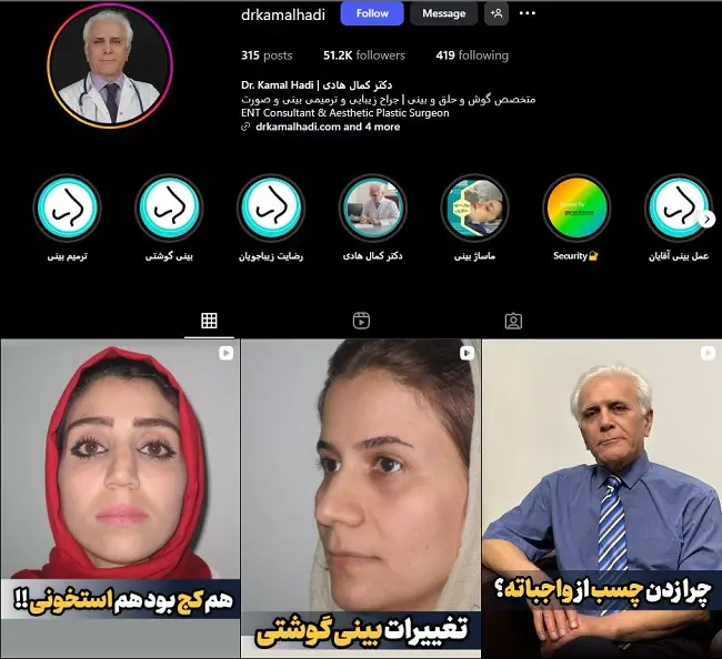 پزشک عمل بینی در رشت، کمال هادی