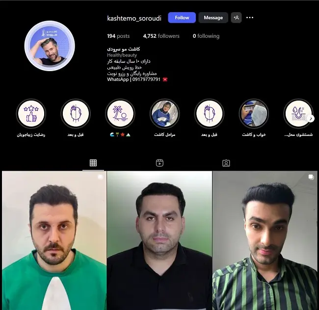 کلینیک کاشت مو سرودی