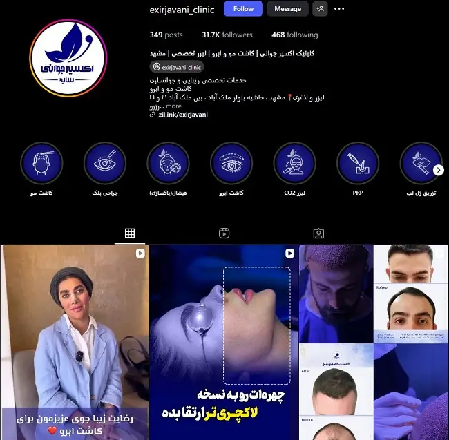 کلینیک اکسیر جوانی، مرکز لیزر در مشهد