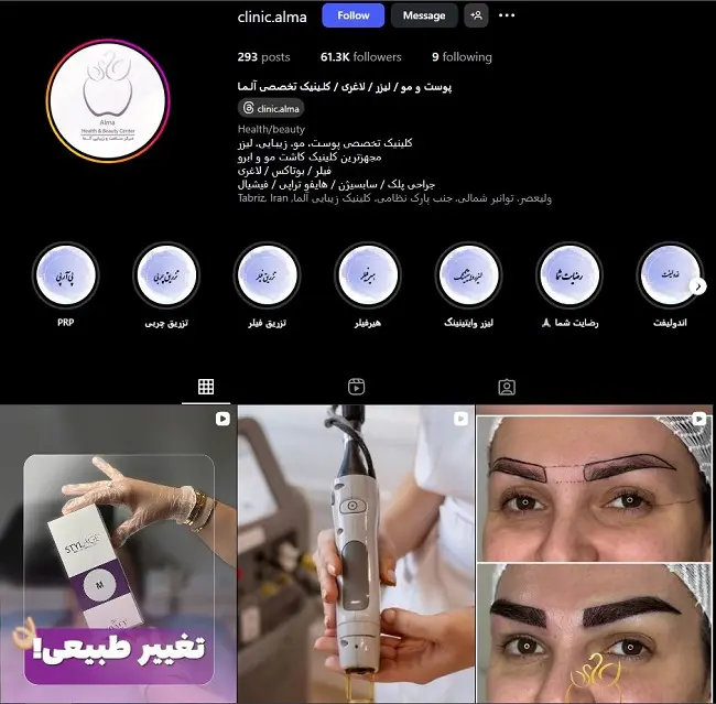 کلینیک لیزر آلما در تبریز