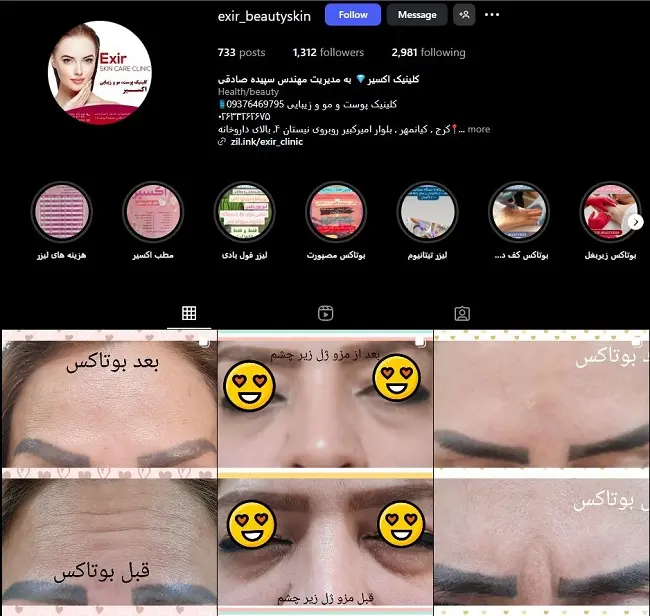 کلینیک لیزر اکسیر