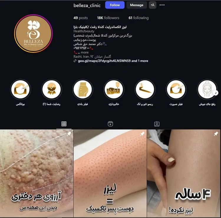 کلینیک لیزر موهای زائد بلزا رشت