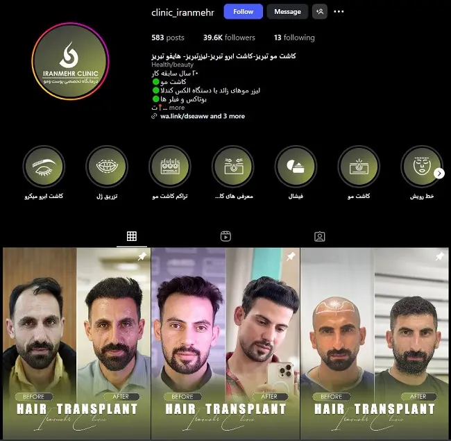 کلینیک کاشت مو ایران مهر