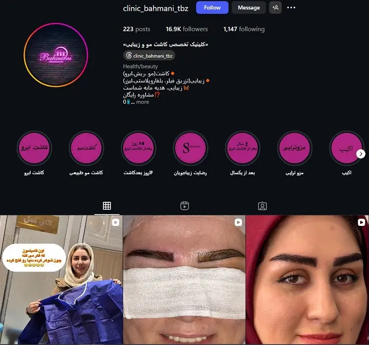 کلینیک تخصصی کاشت مو بهمنی تبریز