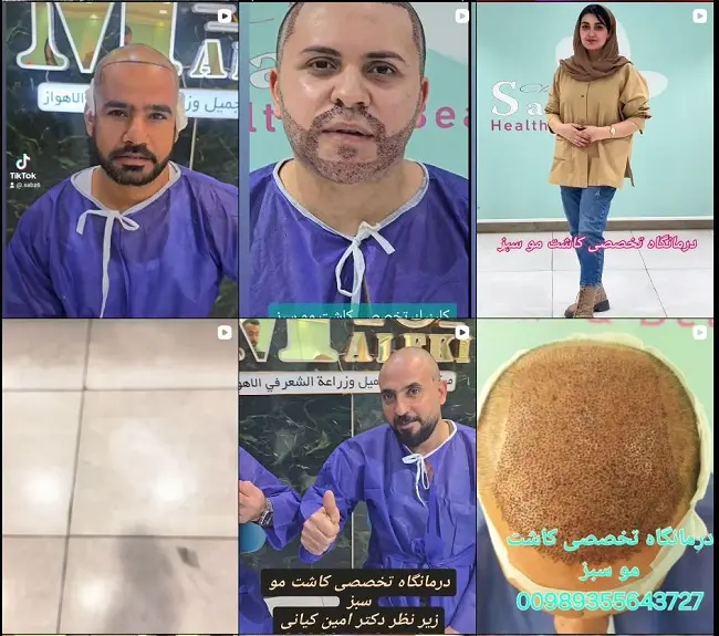 کلینیک تخصصی کاشت موی سبز