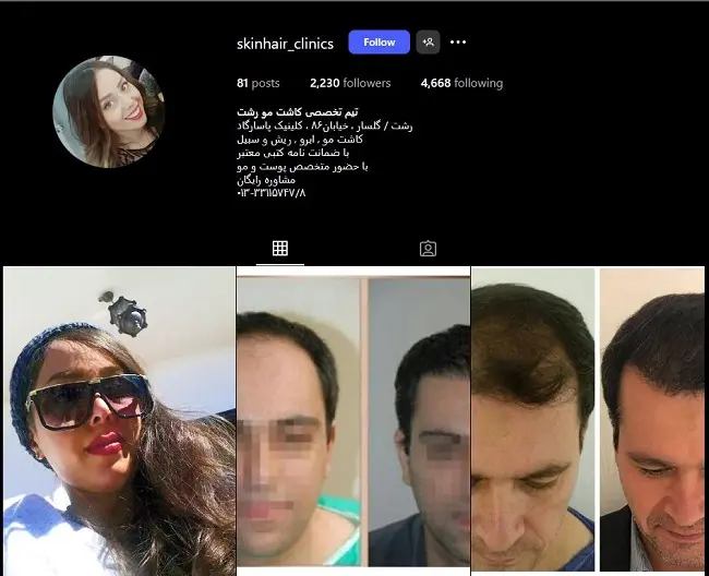 کاشت مو سودا سروری