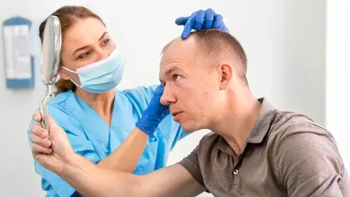 بهترین کلینیک و دکتر کاشت مو در اهواز