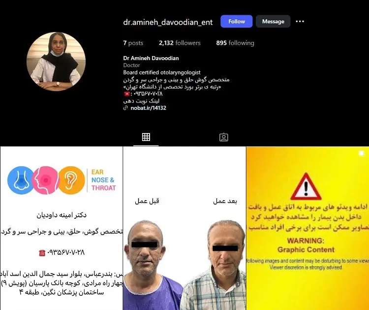 دکتر امینه داودیان، جراح اتوپلاستی در بندرعباس