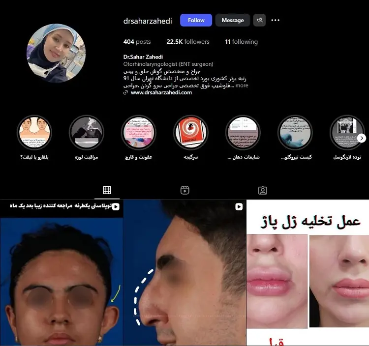 دکتر سحر زاهدی، جراح زیبایی گوش در تبریز