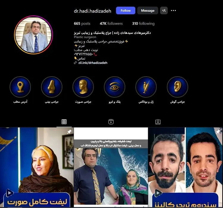 دکتر میر هادی سیدهادی زاده، جراح اتوپلاستی تبریز