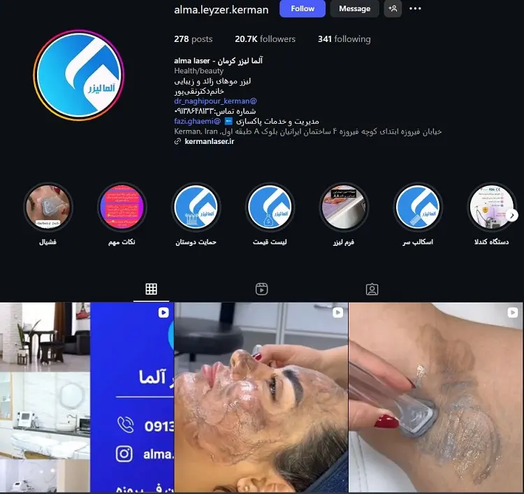 آلما لیزر کرمان