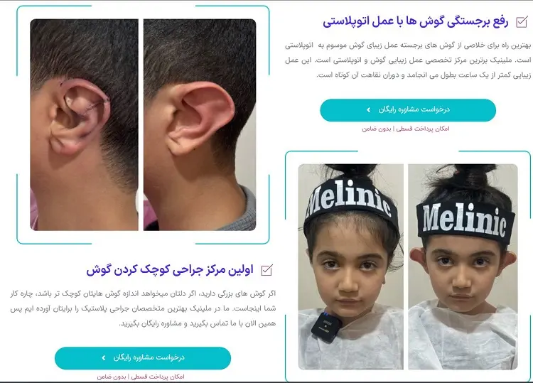 کلینیک اتوپلاستی ملینیک در تهران