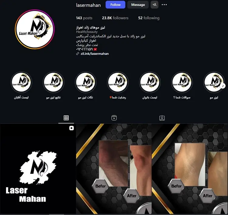 کلینیک لیزر مواهای زائد ماهان در اهواز