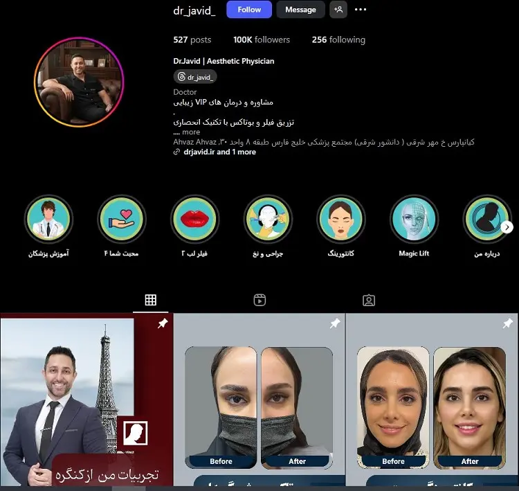 دکتر بوتاکس جاوید اهواز