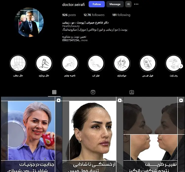 تزریق ژل لب دکتر شاهرخ صیرفی شیراز