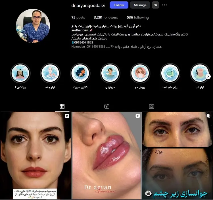 دکتر بوتاکس آرین گودرزی