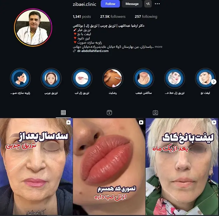 دکتر ارشیا عبداللهی، دکتر بوتاکس در تهران