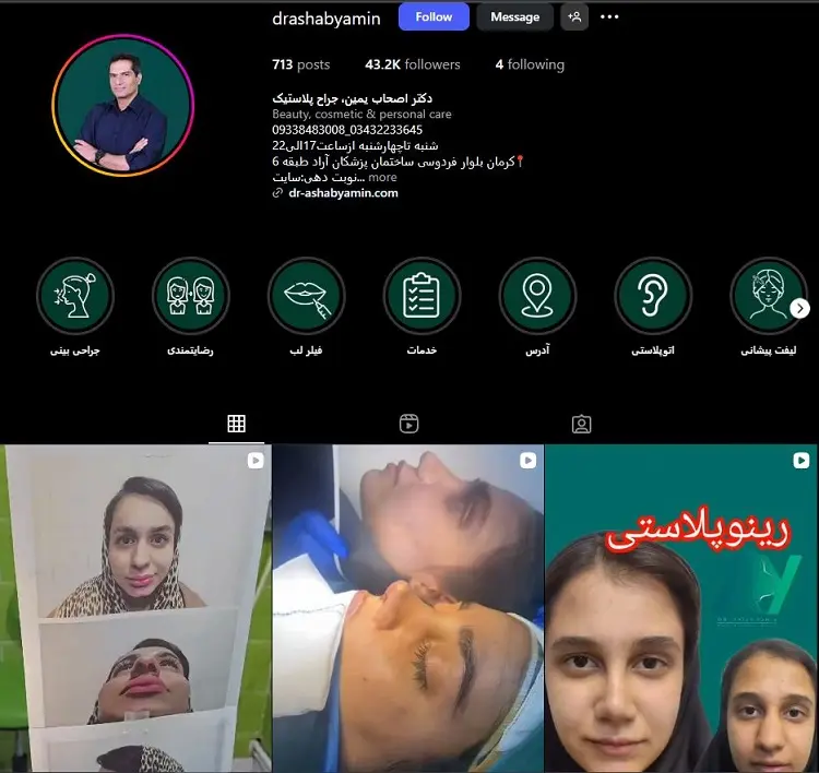 دکتر اصحاب یمین، تزریق ژل لب در کرمان